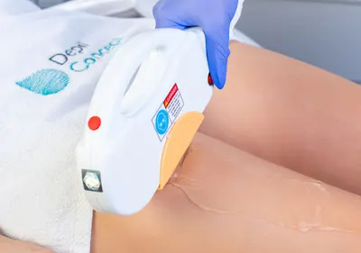 Depilacja Biała Podlaska - DepilConcept